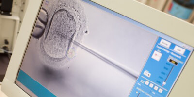 Künstliche Befruchtung - Methoden, Chancen und Kosten